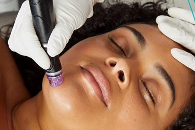 OxyGeneofacial Treatment  vs HydraFacial Treatment :Which One You Should Prefer ?